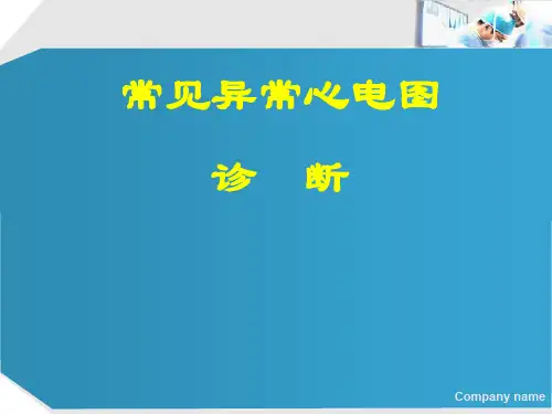 常见异常心电图诊断
