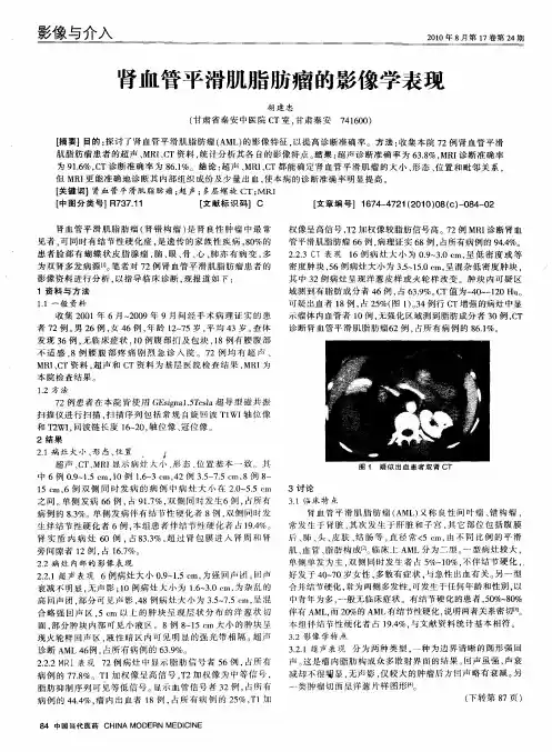 肾血管平滑肌脂肪瘤的影像学表现