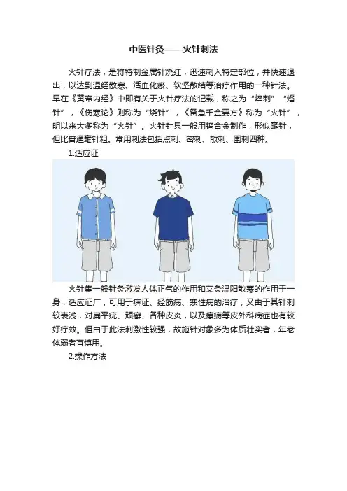 中医针灸——火针刺法