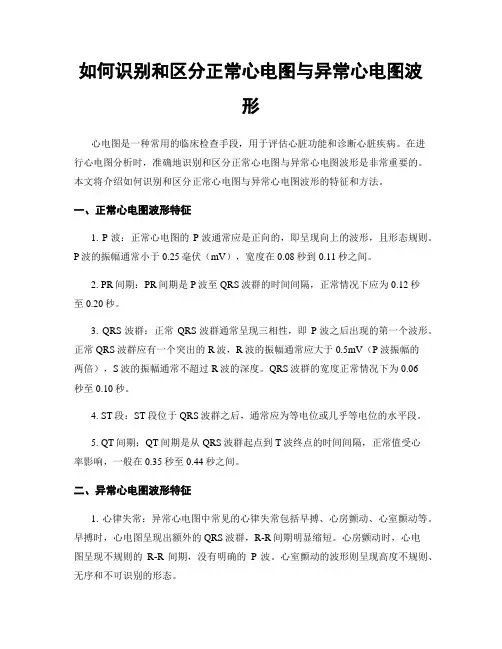 如何识别和区分正常心电图与异常心电图波形