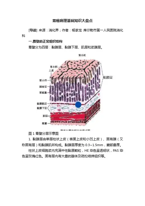 胃癌病理基础知识大盘点