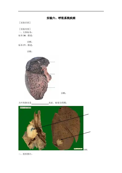 实验六、呼吸系统疾病范本