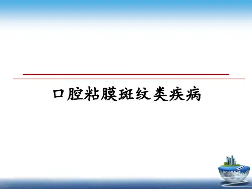 最新口腔粘膜斑纹类疾病课件ppt