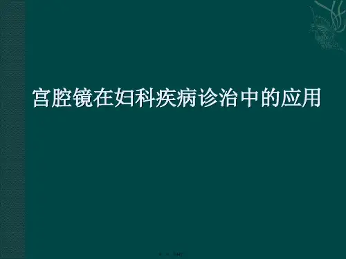 医学资料宫腔镜在妇科疾病诊治中的临床应用ppt课件