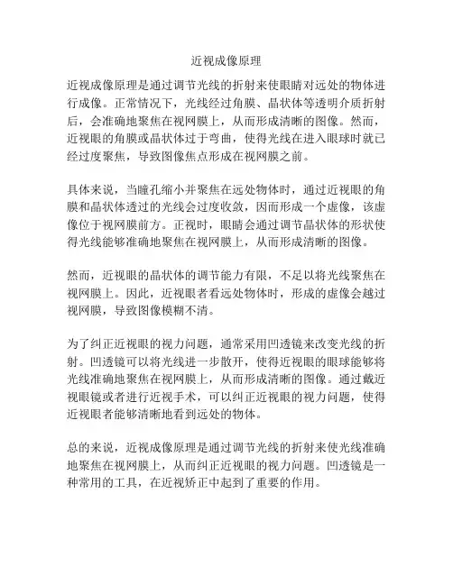 近视成像原理