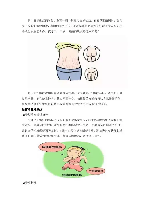 长了妊娠纹怎么办,还可以去掉吗