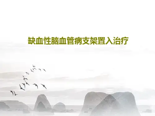 缺血性脑血管病支架置入治疗81页PPT