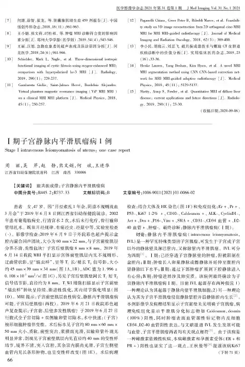 Ⅰ期子宫静脉内平滑肌瘤病1例