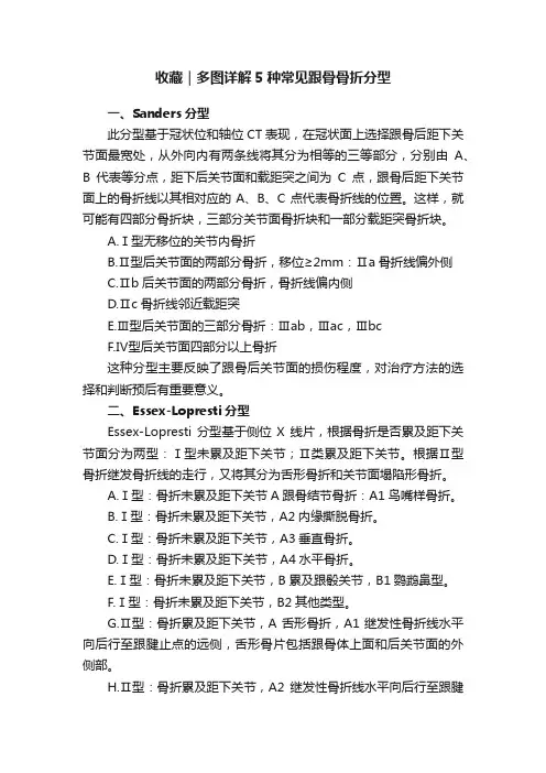 收藏｜多图详解5种常见跟骨骨折分型