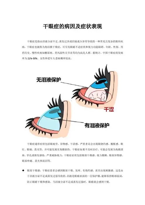 干眼症的病因及症状表现