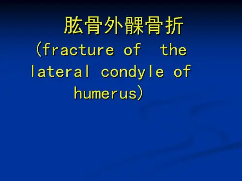 肱骨外髁骨折ppt课件