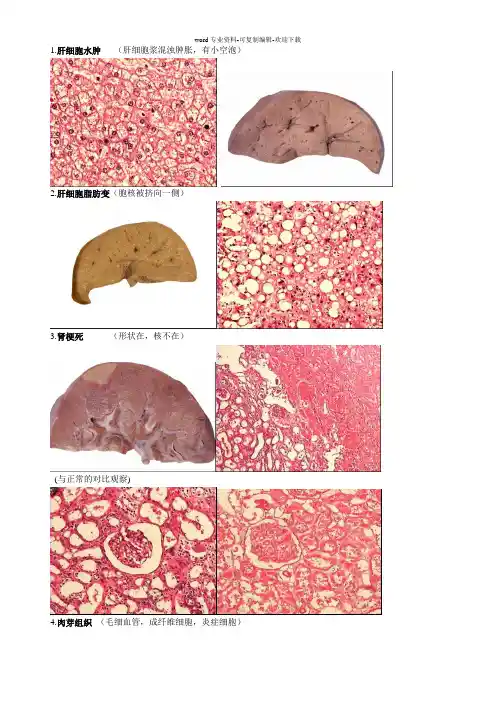 病理实验切片图片整理(第一部分)