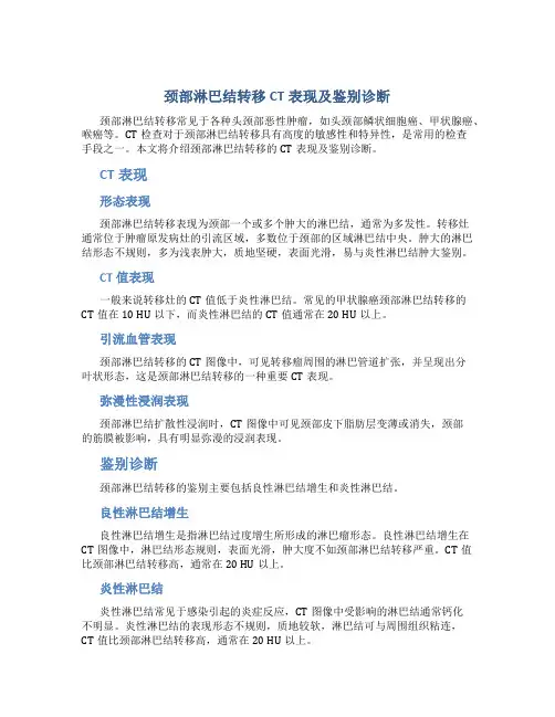 颈部淋巴结转移CT表现及鉴别诊断no