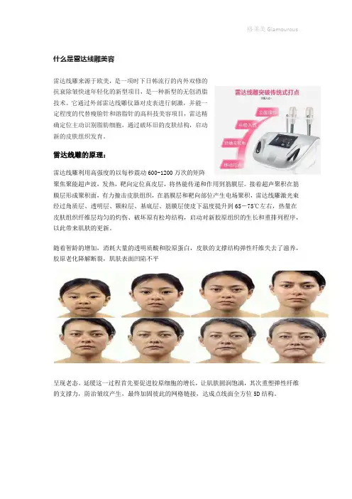 雷达线雕说明书