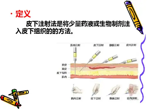 皮下注射法ppt课件