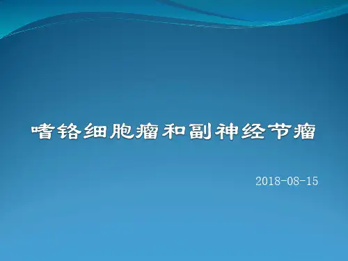 嗜铬细胞瘤(1)