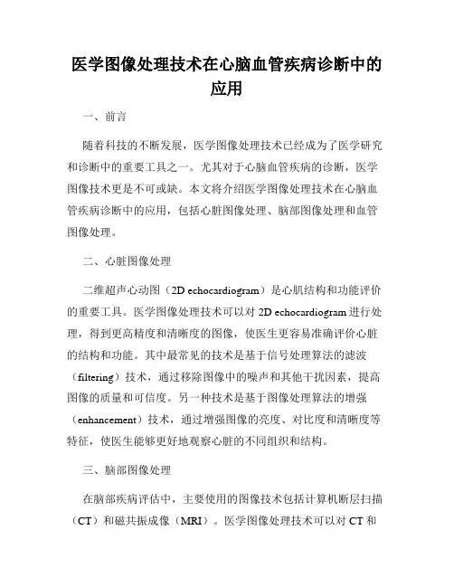 医学图像处理技术在心脑血管疾病诊断中的应用