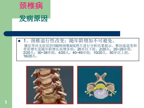 颈腰椎病的预防与自我保健ppt课件.ppt