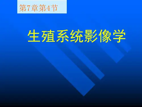 医学影像学PPT生殖系统影像学1课件