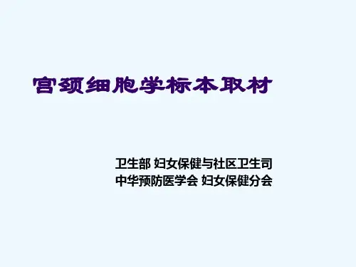 宫颈脱落细胞标本取材要