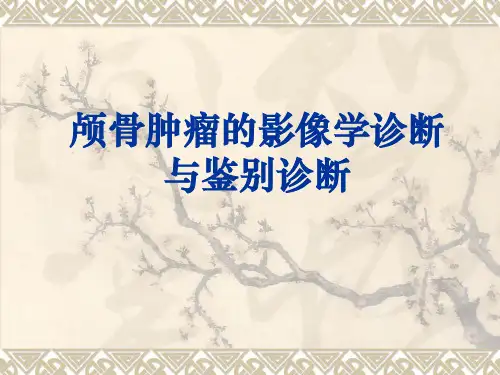 颅骨肿瘤的影像诊断与鉴别诊断