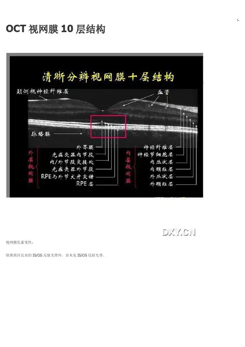 OCT视网膜10层结构
