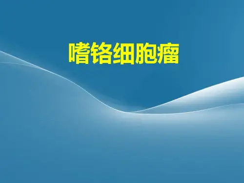 嗜铬细胞瘤