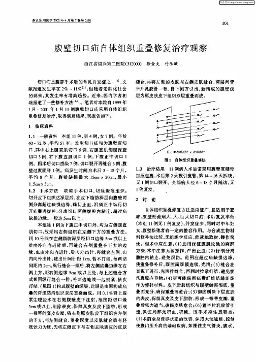 腹壁切口疝自体组织重叠修复治疗观察