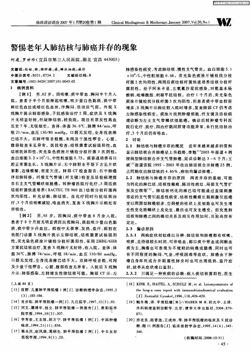 警惕老年人肺结核与肺癌并存的现象