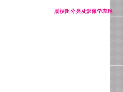 肠梗阻分类及影像学表现