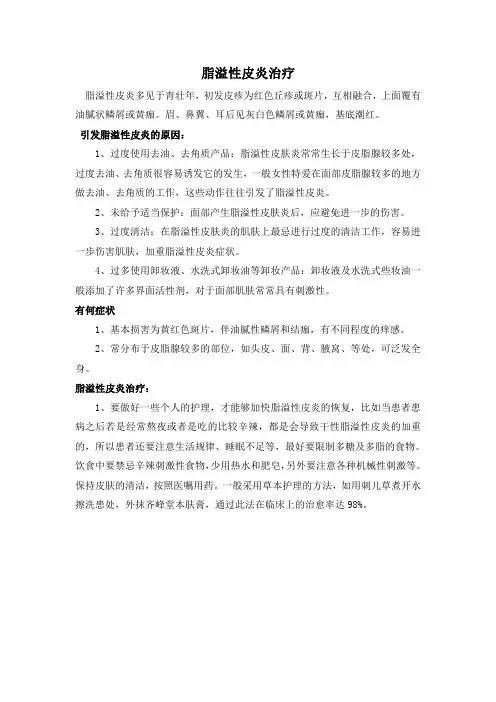 脂溢性皮炎治疗方法