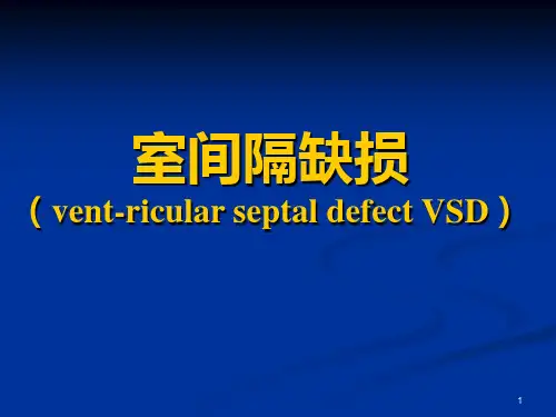 室间隔缺损ppt课件