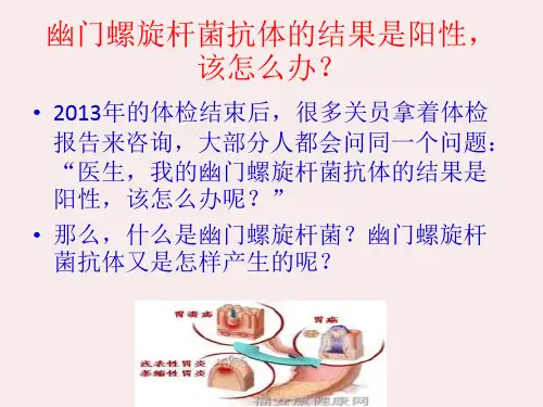 幽门螺旋杆菌抗体阳性怎么办