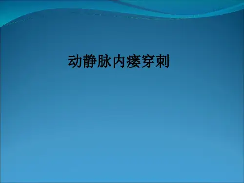动静脉内瘘穿刺ppt课件