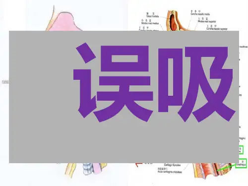 《误吸》ppt课件