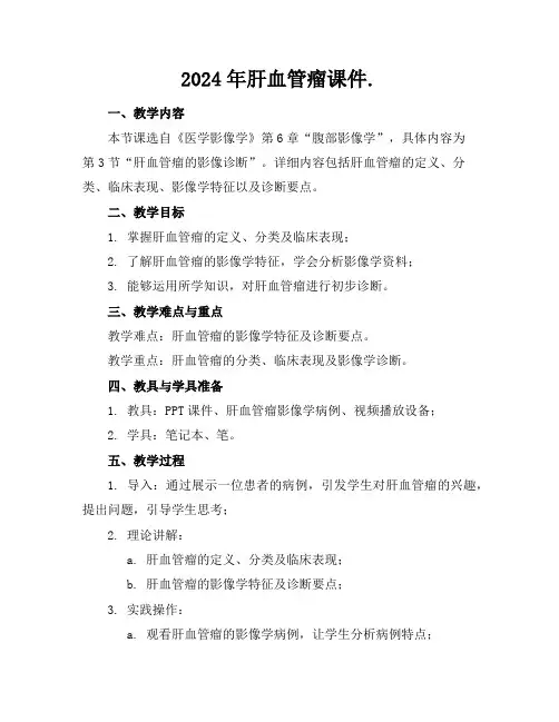 2024年肝血管瘤课件.