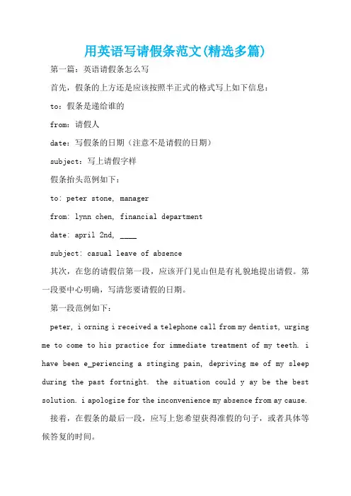 用英语写请假条范文(精选多篇)  