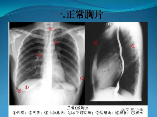 快速掌握X线胸片阅读