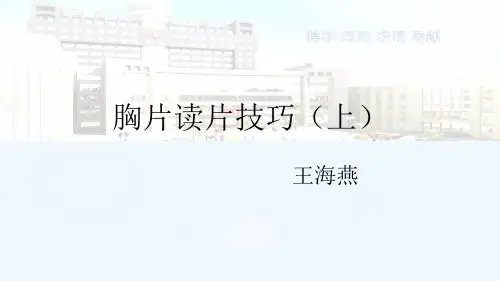胸片读片技巧上