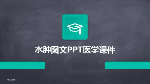 水肿图文PPT医学课件