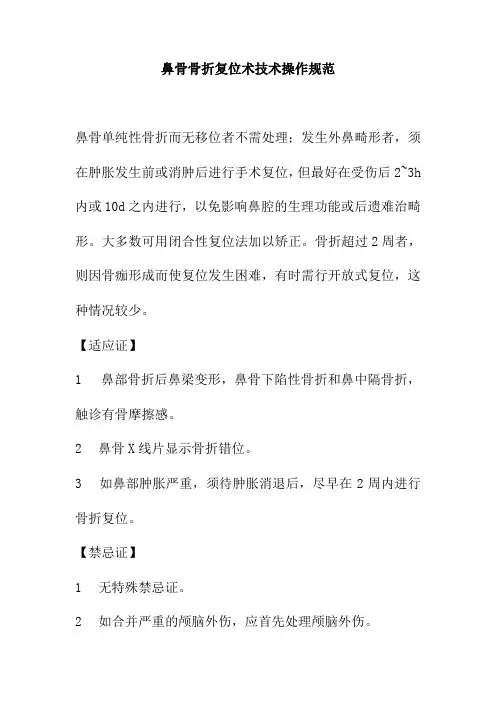 鼻骨骨折复位术技术操作规范
