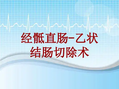手术讲解模板：经骶直肠-乙状结肠切除术