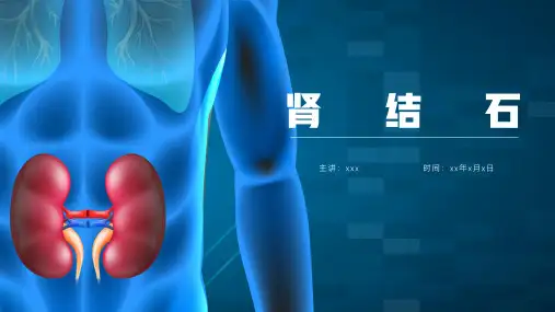 肾结石的治疗ppt