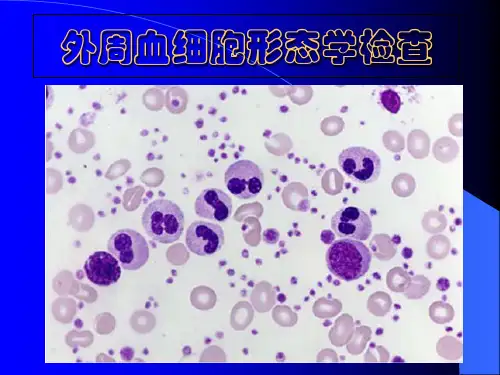 检验科 外周血涂片检查ppt课件