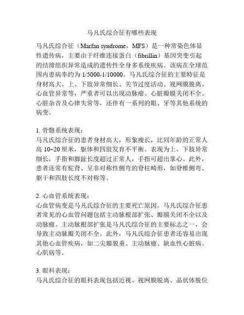 马凡氏综合征有哪些表现