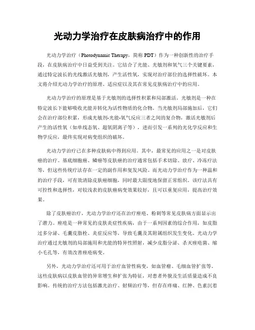 光动力学治疗在皮肤病治疗中的作用