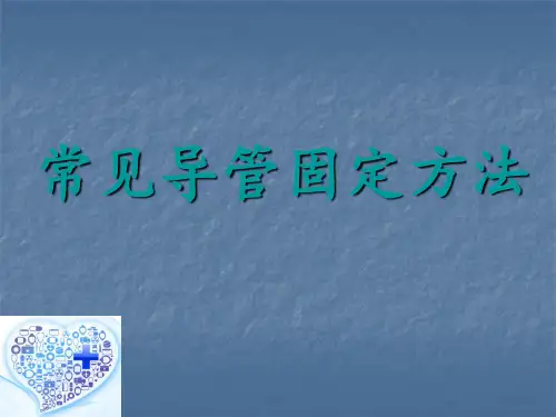 常见导管固定方法ppt课件