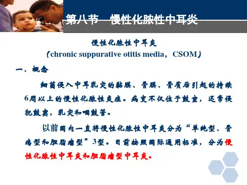 临床医学-耳鼻喉科-慢性化脓性中耳炎 (2)