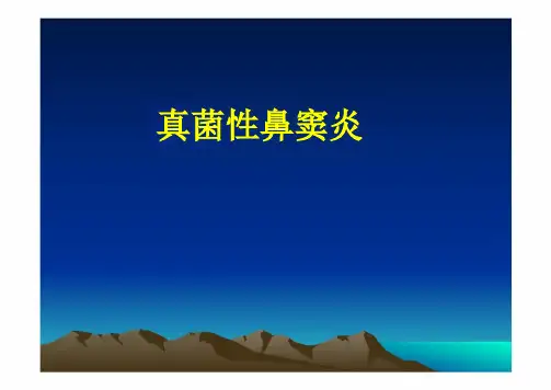 真菌性鼻窦炎 ppt课件【14页】