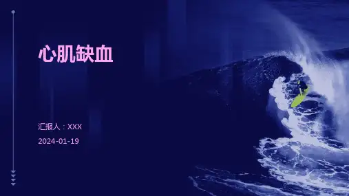 心肌缺血演示ppt课件